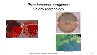 Nonfermenting Gram Negative Bacilli [upl. by Anna-Diana]