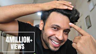 HOW I STOPPED MY HAIR FALL  क्या आपके बाल झड़ते है  ज़रूर देखिये  UrIndianConsumer [upl. by Elram]