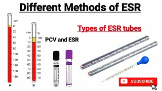 ESR test in hindi  Different methods of estimating ESR  ESR by Wintrobe and westergren Method [upl. by Esenwahs956]