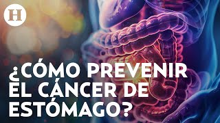 Pérdida de peso inexplicable y dificultad para tragar síntomas del cáncer de esófago y estómago [upl. by Holden670]