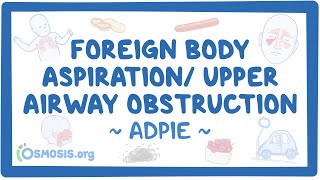 Foreign body aspiration  upper airway obstruction Nursing Process [upl. by Nilknarf]