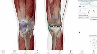 MCL ligament Individual activity TMO 1 [upl. by Noirrad545]