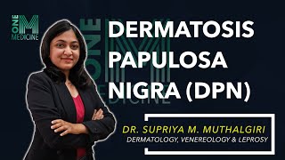 Dermatosis Papulosa Nigra DPN  Dermatology  OneMedicine [upl. by Nnyllatsyrc47]