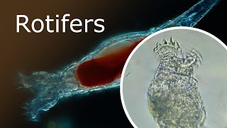 All About Rotifers Anatomy and Habitat Rotaria Macrura Under a Microscope 100x250x [upl. by Neelsaj692]