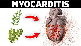 The Best Remedies for Myocarditis [upl. by Martinelli]