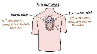 Heart Murmurs and Heart Sounds Visual Explanation for Students [upl. by Singhal]