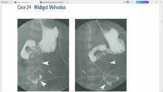 RADIOLOGY EXAM CASES [upl. by Nhtanhoj599]