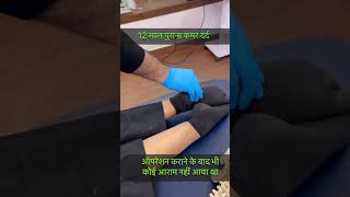 Dry Needling Treatment For Back Pain by Dr Rachit bajaj Chiropractor [upl. by Aileme]