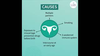 Things You Need to Know About Cervical Cancer  CARE Hospitals [upl. by Ahtiek]