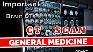 CT  SCAN GENERAL MEDICINEDRAKD [upl. by Lesoj]