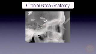 Cranial Base Superimposition [upl. by Len]