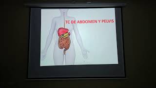 TOMOGRAFÍA DE ABDOMEN Y PELVIS ANATOMIA Y REALIZACION DESDE EL AULA [upl. by Korfonta]