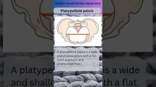 Platypelloid pelvis Types of pelvis  obg And Gynae Nursing image Base Question Norcet 08ytshorts [upl. by Joyce]