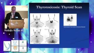 Monday Thyroid and Parathyroid Scintigraphy Rodolfo Nuñez [upl. by Hortense]