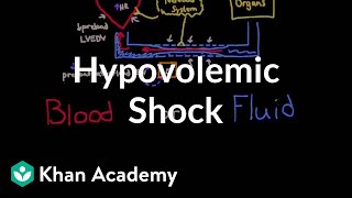 Hypovolemic shock  Circulatory System and Disease  NCLEXRN  Khan Academy [upl. by Cutcliffe422]