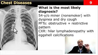 Chest case Diagnose it internalmedicine cme usmle محاضراتباطنة ecg clinical [upl. by Stephannie]