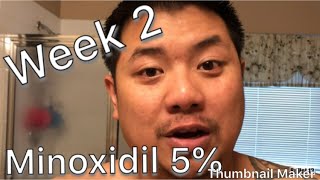 ASIAN Beard Growth Using MINOXIDIL Week 2 [upl. by Legin]