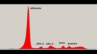 Práctica 3  Electroforesis de proteínas del suero [upl. by Yssej632]