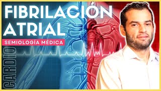 Semiología cardiovascular  Fibrilación atrial [upl. by Witha351]