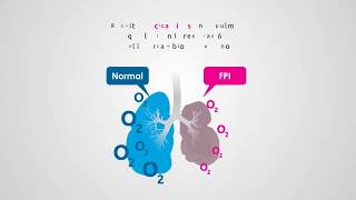 Fibrosis Pulmonar Idiopática FPI  Infografía Animada [upl. by Toy409]