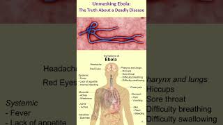 Unmasking Ebola The Truth About a Deadly Disease ebola disease virus [upl. by Etiragram]