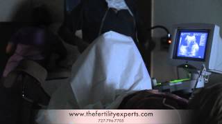 IVF Embryo Transfer [upl. by Neil]