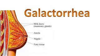 Galactorrhea [upl. by Ear]