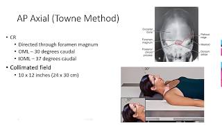 Radiographic Positioning of the Skull [upl. by Elata]