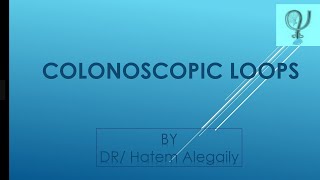 Colonoscopic loops [upl. by Ayatnahs]