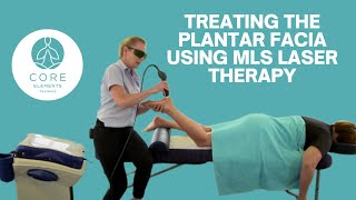 Treatment to the Plantar Fascia using MLS Laser Therapy [upl. by Zakaria301]