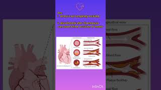 Why is Thrombolysis Contraindicated in STEMI myocardialinfarction myocarditis [upl. by Ajax]