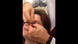 How to double evert the upper eyelid using a bent paperclip [upl. by Gillett404]