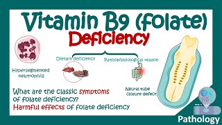 Folate deficiency  What are the symptoms of low folic acid  Harmful effects of Folate deficiency [upl. by Xuagram]