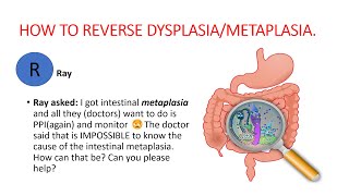 Metaplasia dysplasia How to reverse dysplasia metaplasia Natural treatment [upl. by Santa]