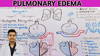 pulmonary edema pathophysiology in Hindi  cardiogenic pulmonary edema [upl. by Nlyak589]