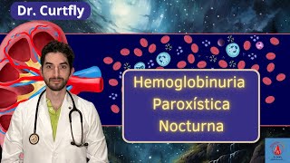 Hemoglobinuria Paroxística Nocturna Etiología Fisiopatología Clínica Diagnóstico y Tratamiento [upl. by Ytomit255]