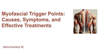 Myofascial Trigger Points Causes Symptoms and Effective Treatments [upl. by Sallee]