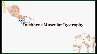 Duchhene muscular dystrophy  clinical features  etiology  pathogenesis  diagnosis  treatment [upl. by Stefania309]