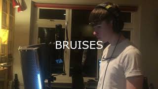 Bruises  Lewis Capaldi Cathal Mulvey Cover [upl. by Ajdan]