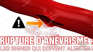 LA RUPTURE DANÉVRISME  UNE URGENCE VITALE [upl. by Ogires460]