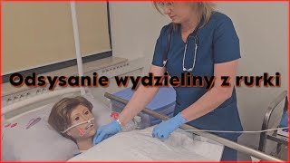 Odsysanie wydzieliny z rurki tracheostomijnej oraz jamy ustnej pacjenta [upl. by Lleval452]