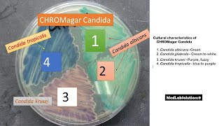 Candida albicans Candida krusei and Candida tropicalis colony morphology on Candida Chromagar [upl. by Peddada]