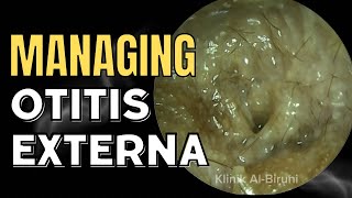 Managing Otitis Externa [upl. by Teirtza]