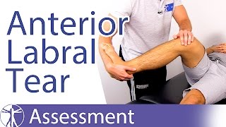 Anterior Labral Tear Test⎟Labral Tear [upl. by Marola]