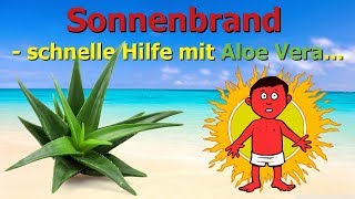 Sonnenbrand  schnelle Hilfe mit Aloe Vera  die Anwendung [upl. by Arihas]