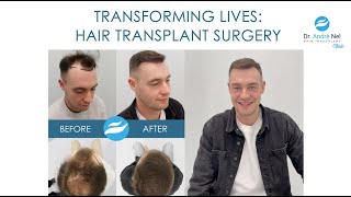 Transforming Lives Our Latest Hair Transplant by Dr Andre Nel [upl. by Aisauqal537]