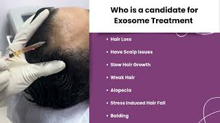 Exosome Treatment l Hair Loss l Balding l Hair Fall l Twacha l Dwarka l Delhi [upl. by Opaline]