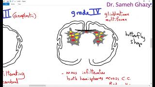 Systemic pathology 15  CNS 1 tumors of CNS  DRSAMEH GHAZY [upl. by Nanci]