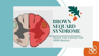 Brown SeQUARD syndrome Master your concept with MBBS Journeymbbs physio concept [upl. by Eesac]