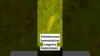 Schistossoma haematobium com reagente PARASIMAX [upl. by Silvano]